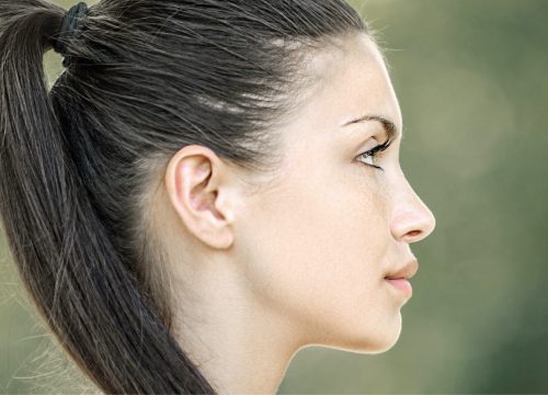 Woman's ears after ear surgery