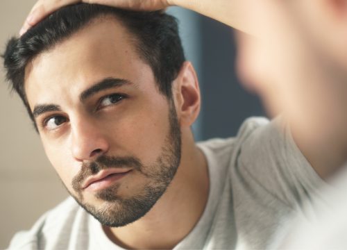 Man dealing with hair loss & thinning