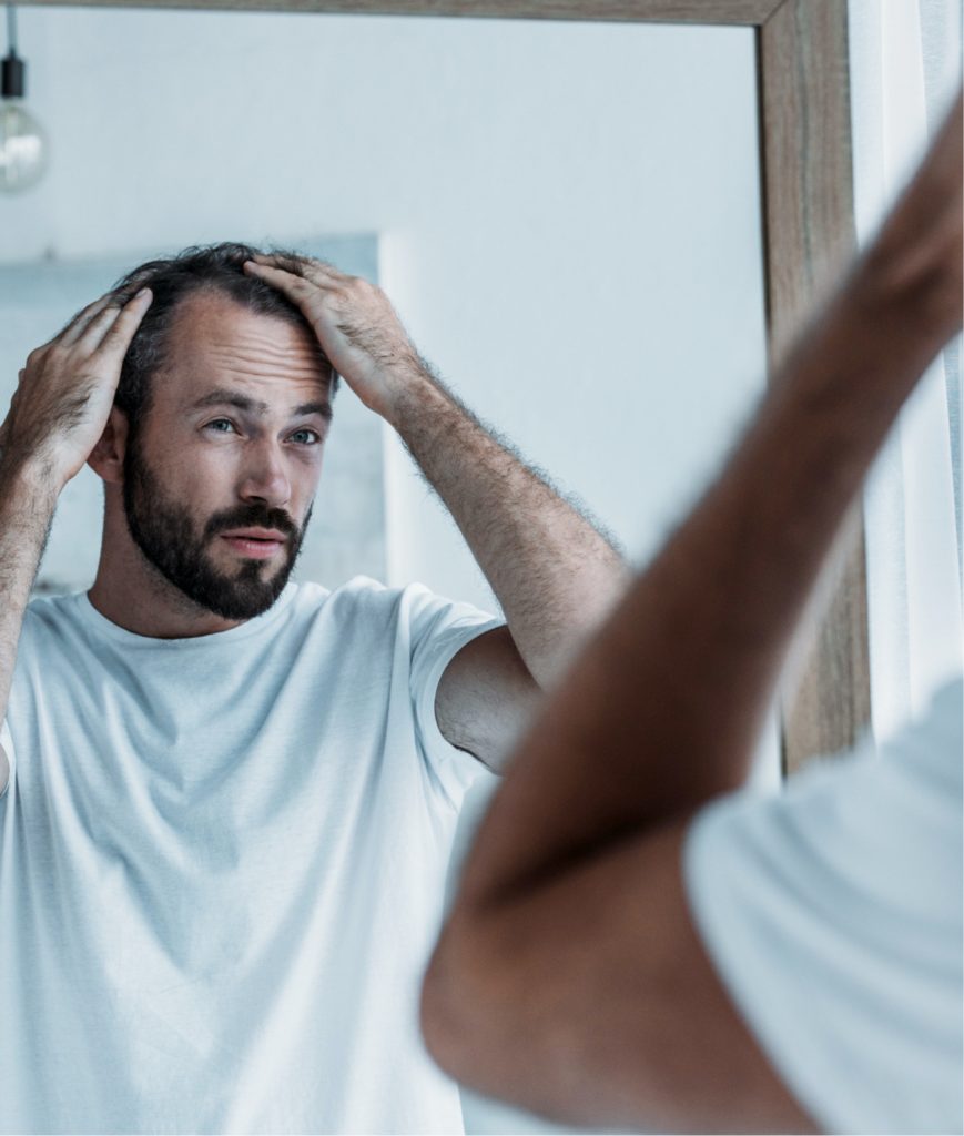 Man inspecting his hairline