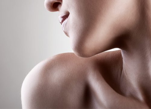 Woman's neckline after neck lift surgery