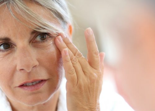 Wrinkles and fine lines on a woman's face