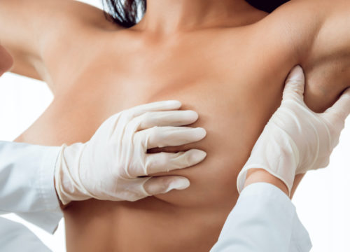 Doctor examining a woman's breasts
